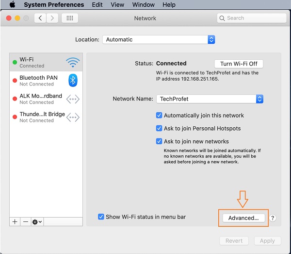 click on advanced on Macbook network settings